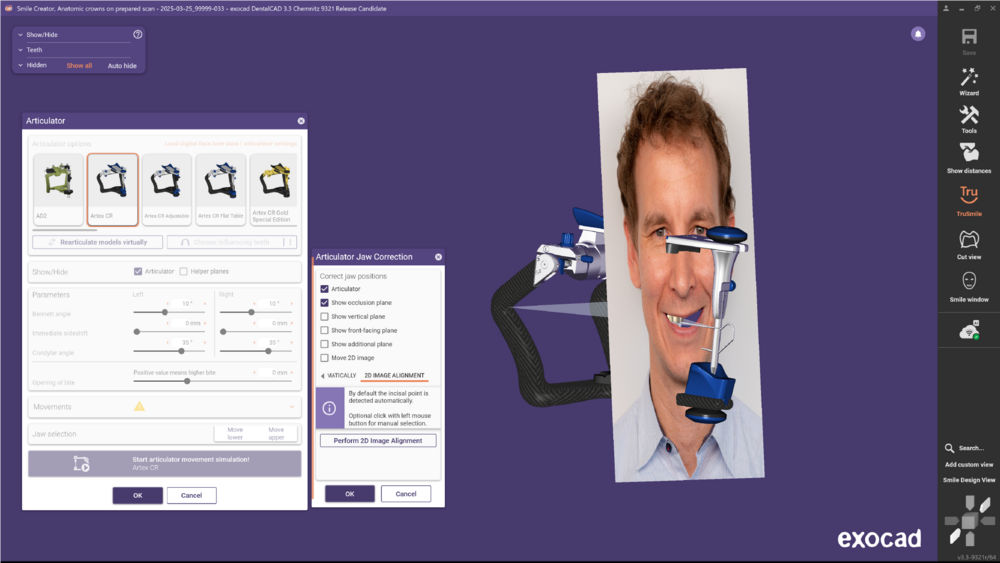 Articulator 3.3 4.png