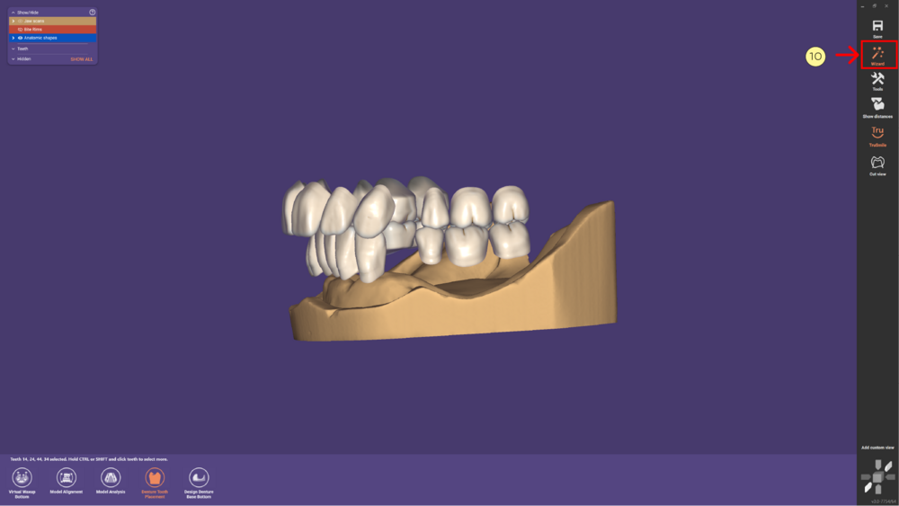 Denture remove teeth4-08.png