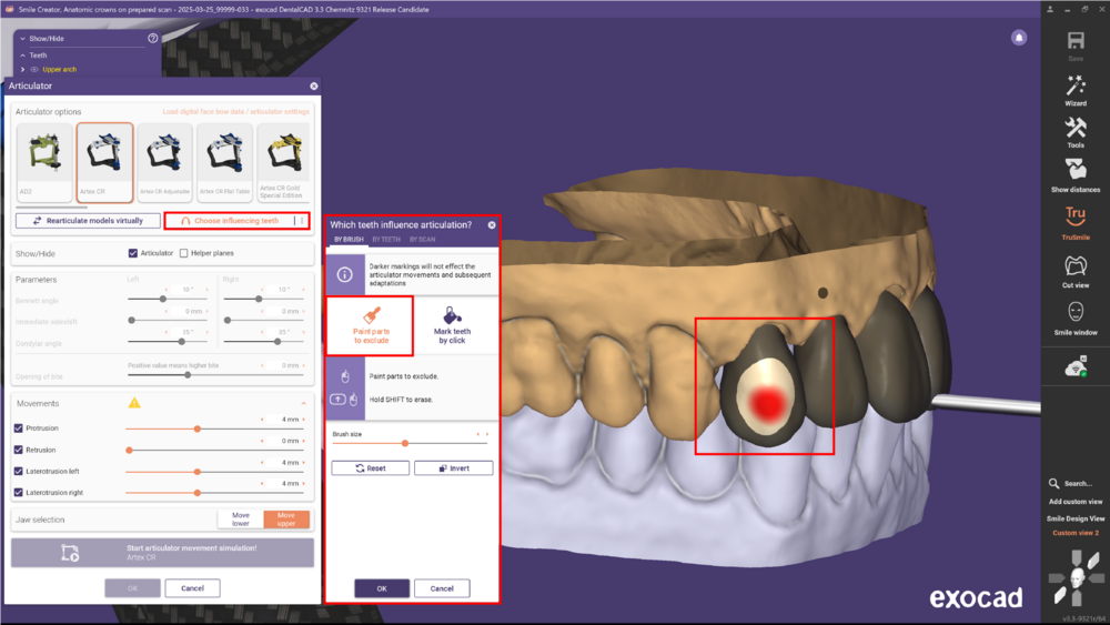 Articulator 3.3 6.png