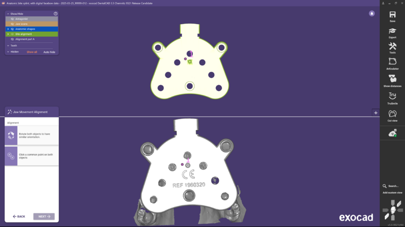 File:3.3 Jaw movement-04.png