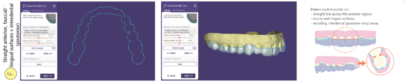 File:Bitesplint top F SR.png