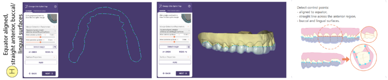 File:Bitesplint top H SR.png