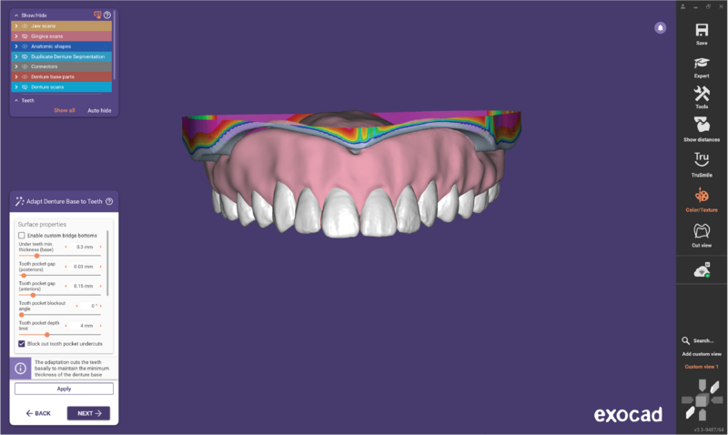 File:Duplicate denture3.3-13.png
