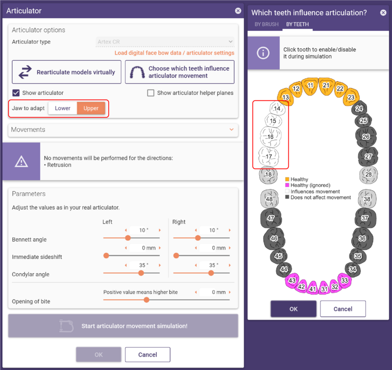 Virtual articulator both 2b 3.2.png