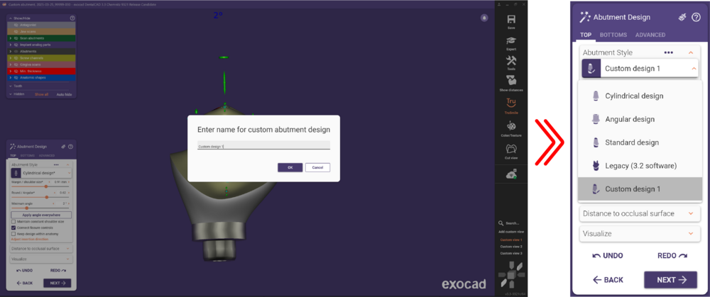 Abutment design top 3.3 5.png