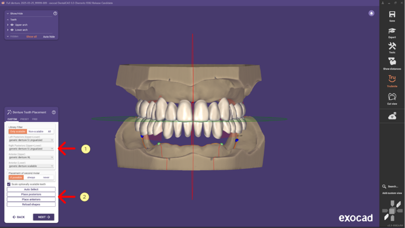 File:Denture remove teeth4-02 3.3.png