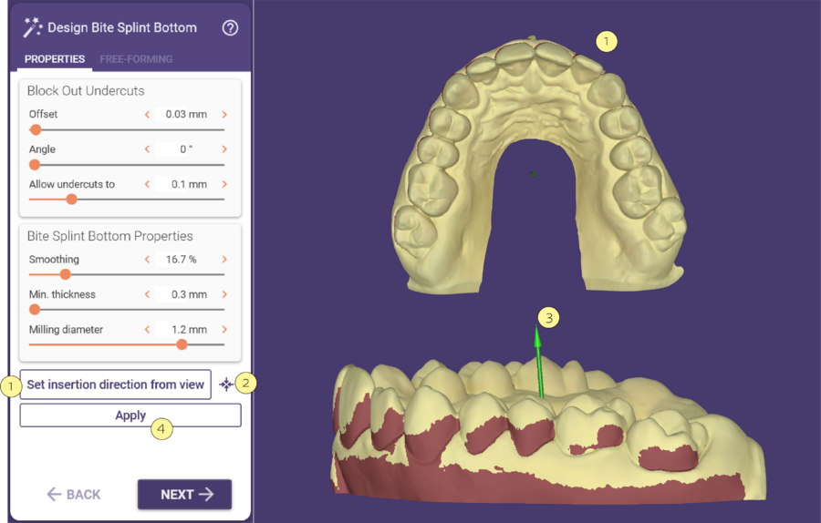 Design Bite splint bottom insertion.png