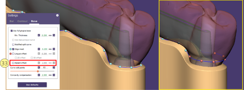 File:Split bar partial-17.png