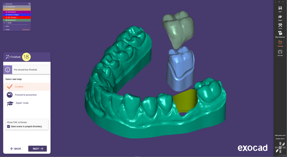 Provisional model-11.PNG