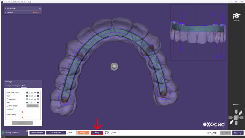 File:Split bar partial-11.png