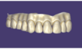 Thumbnail for version as of 15:38, 15 April 2026