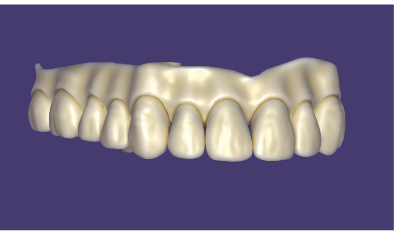 File:FP3-01.png