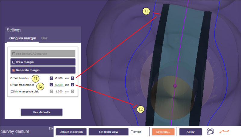 File:Split bar partial-08.png