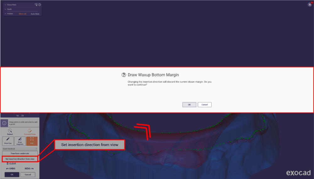 Split bar 3.3-22.png