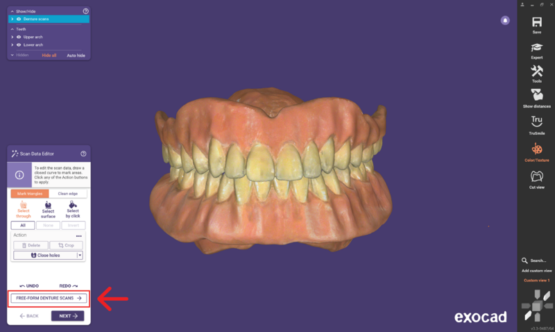 File:Duplicate denture3.3-03.png