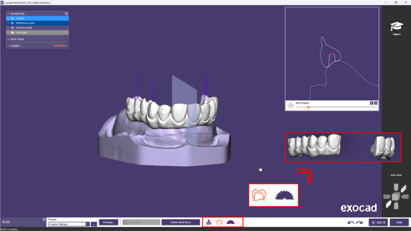 File:Split bar partial-32.png