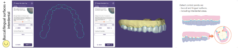 File:Bitesplint top C SR.png