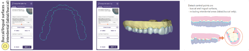 File:Bitesplint top D SR.png