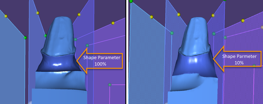 ShapeParameter.png