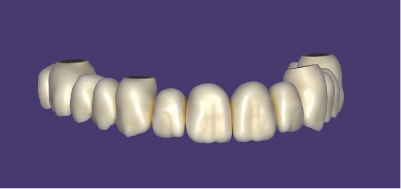 File:FP1.png