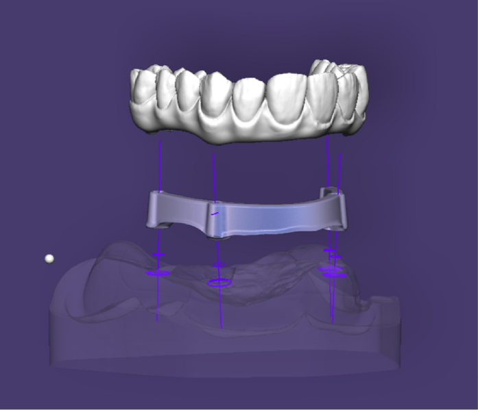 File:Split bar partial-0.png