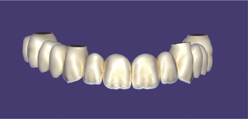 File:FP1-04.png