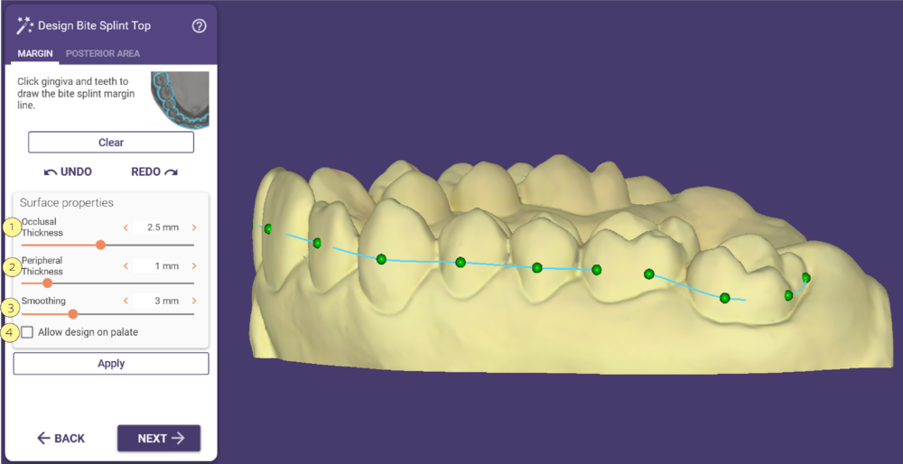 Design Bite splint Top.PNG