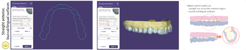 File:Bitesplint top E SR.png