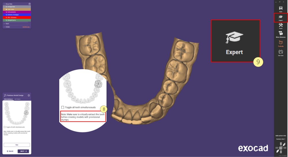 Provisional model-04.PNG