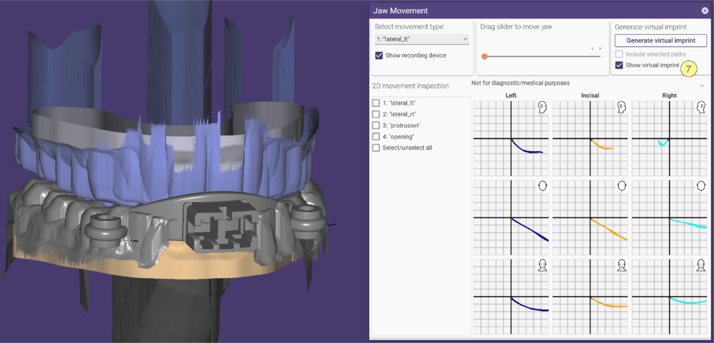 Jaw movement-08 3.2.png