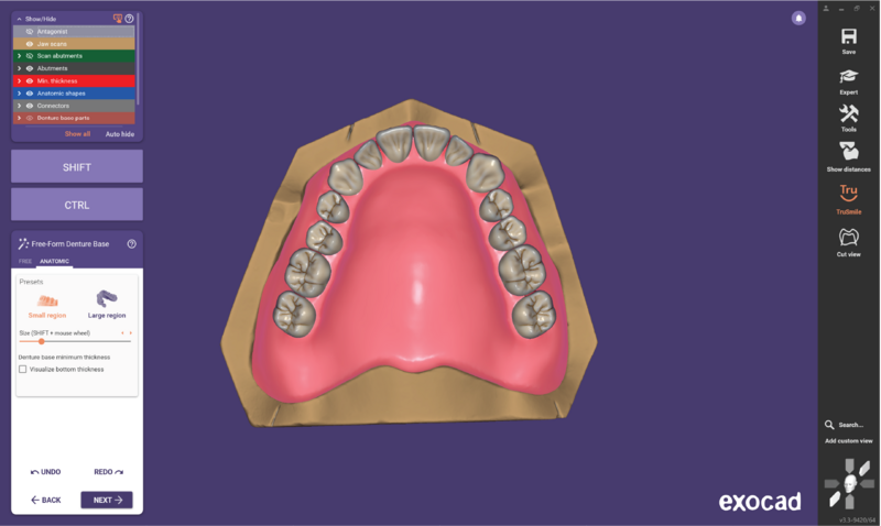 File:O ball attach 3.3-15.png