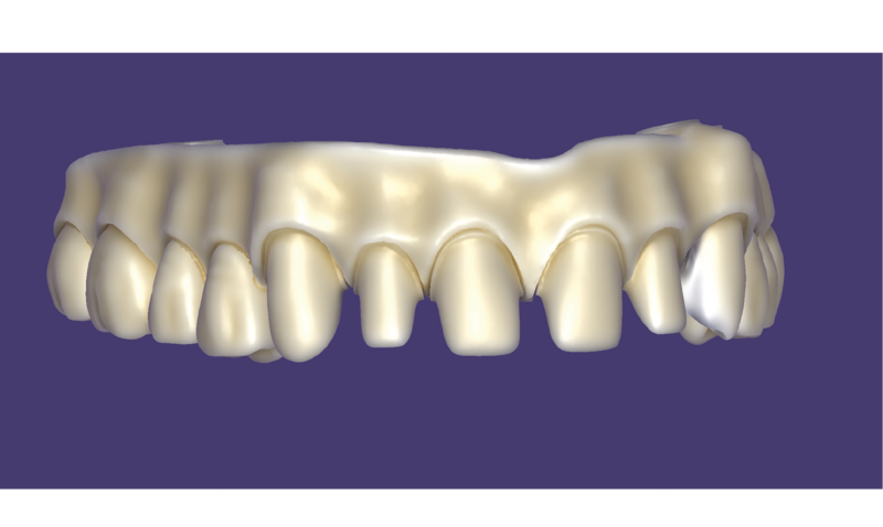File:FP3-11.png