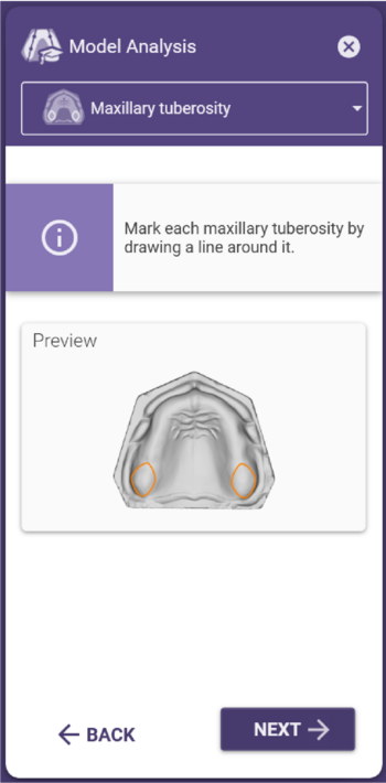 Full model analysis maxillary tuberosity.png