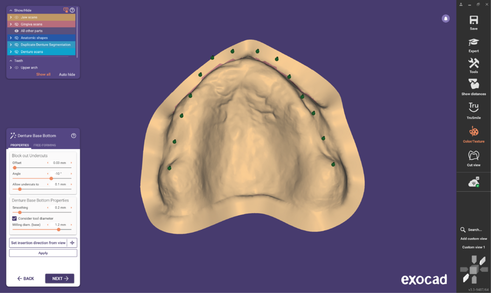 Duplicate denture3.3-10.png