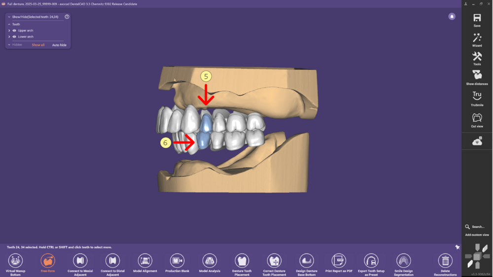 Denture remove teeth4-04 3.3.png