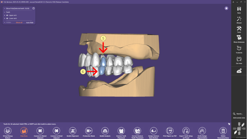 File:Denture remove teeth4-04 3.3.png