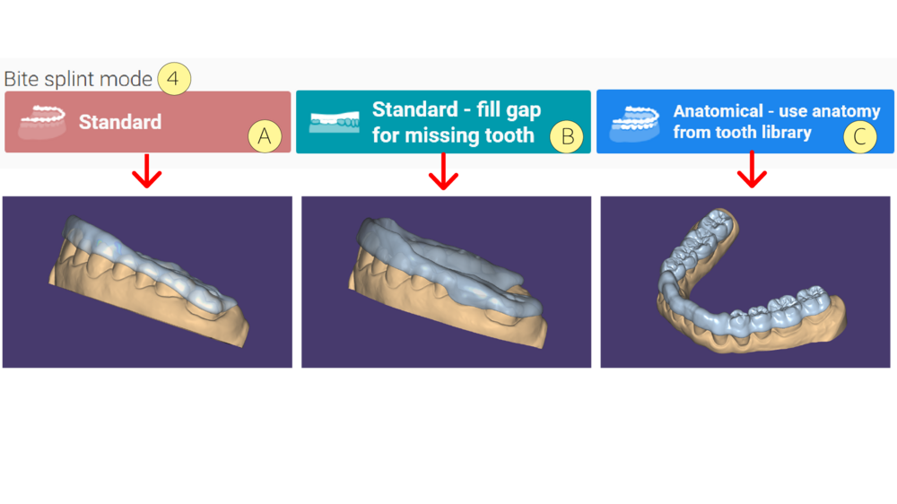Bitesplint 3.3 1-02.png