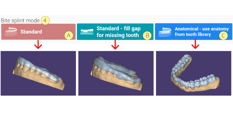 File:Bitesplint 3.3 1-02.png
