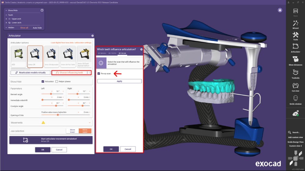 Articulator 3.3 8.png
