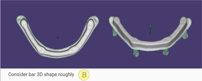 Split bar 3.3-10.png