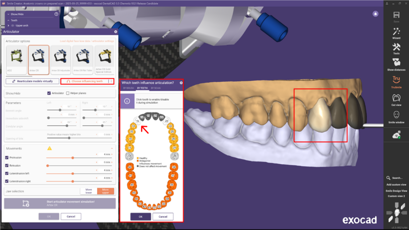 File:Articulator 3.3 7.png