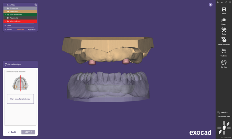 File:O ball attach 3.3-08.png