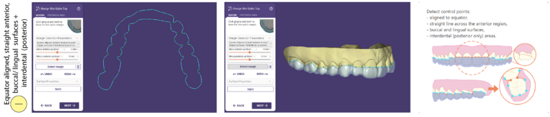 File:Bitesplint top I SR.png