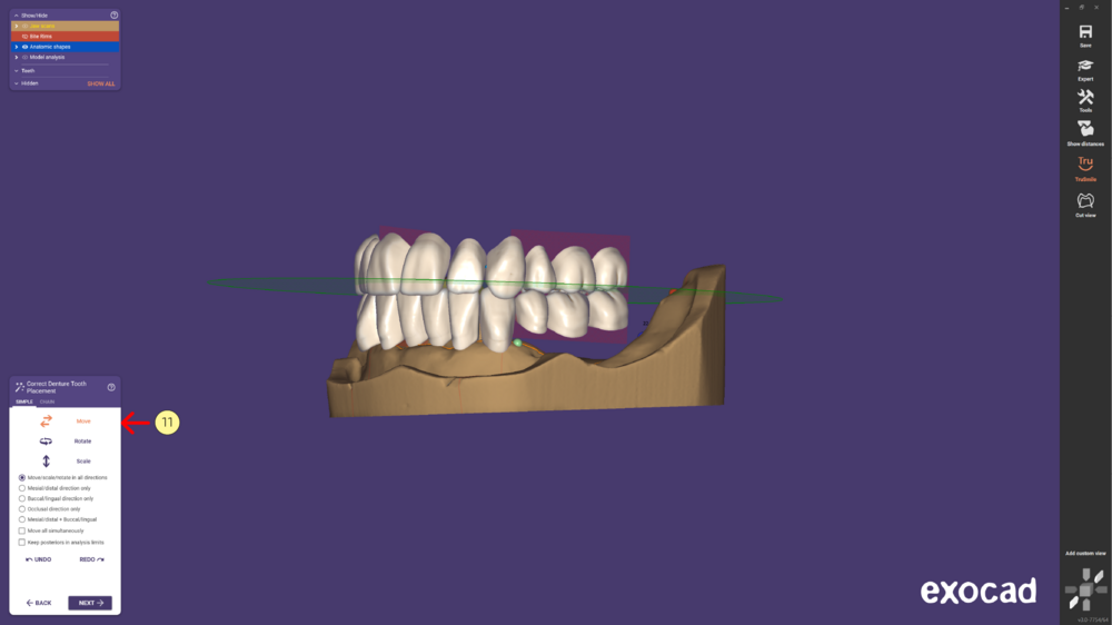 Denture remove teeth4-09.png