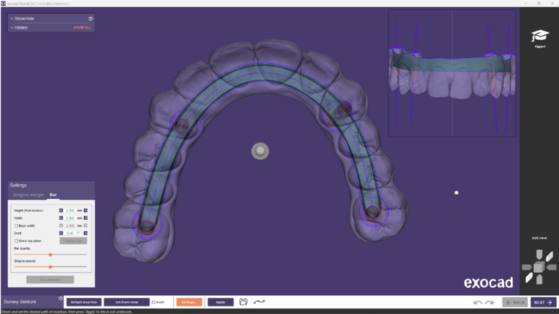 File:Split bar partial-05.png