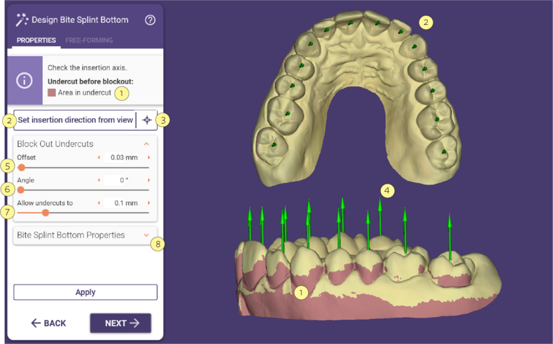 File:Bitesplint bottom 1.png