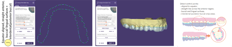 File:Bitesplint top J SR.png