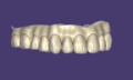 Thumbnail for version as of 15:38, 15 April 2026