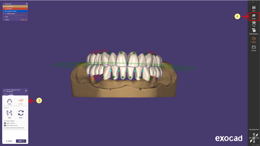 Denture remove teeth4-03.png