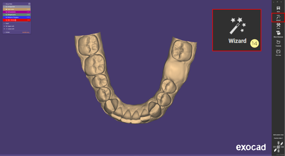 Provisional model-07.PNG